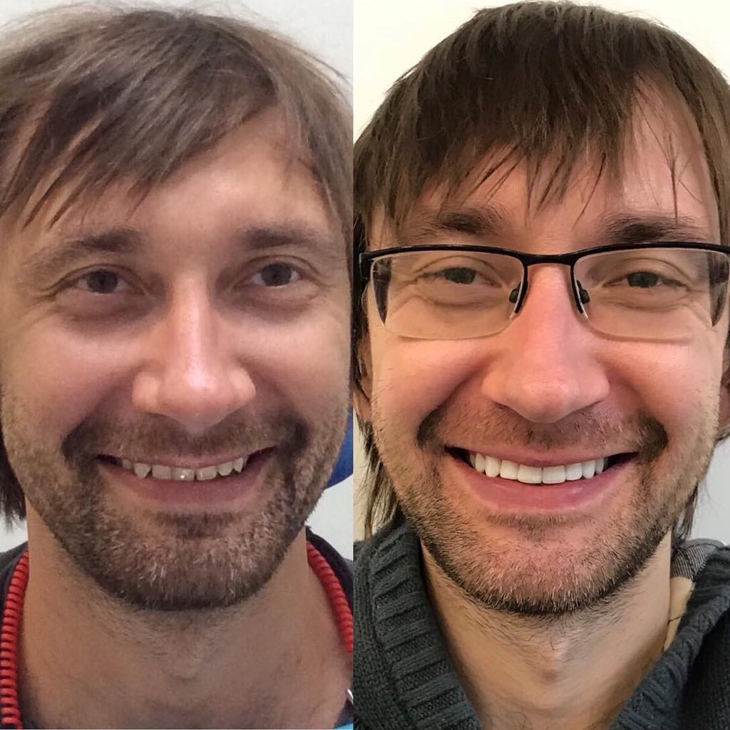 Как БЫЛО как СТАЛО