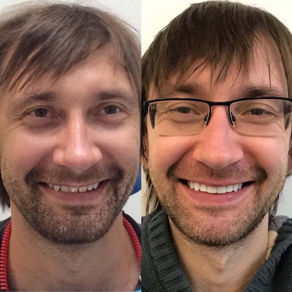 ДО відвідування стоматолога та ПІСЛЯ