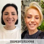 Цифрове встановлення брекет системи